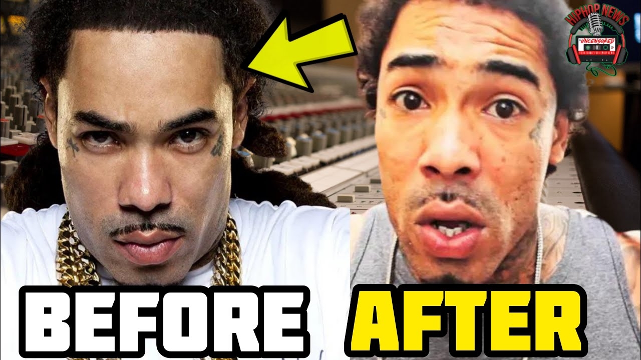 Rick Ross's Artist Gunplay Shows The Devastating Effects Of Cocaine Use!
