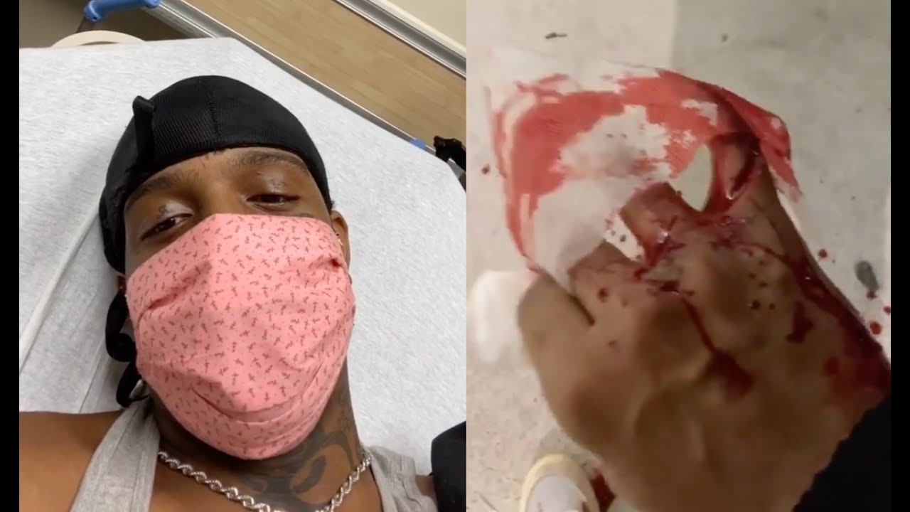 Ski Mask The Slump God Rushed To The Hospital After Cutting His Fingers Down To The Bone
