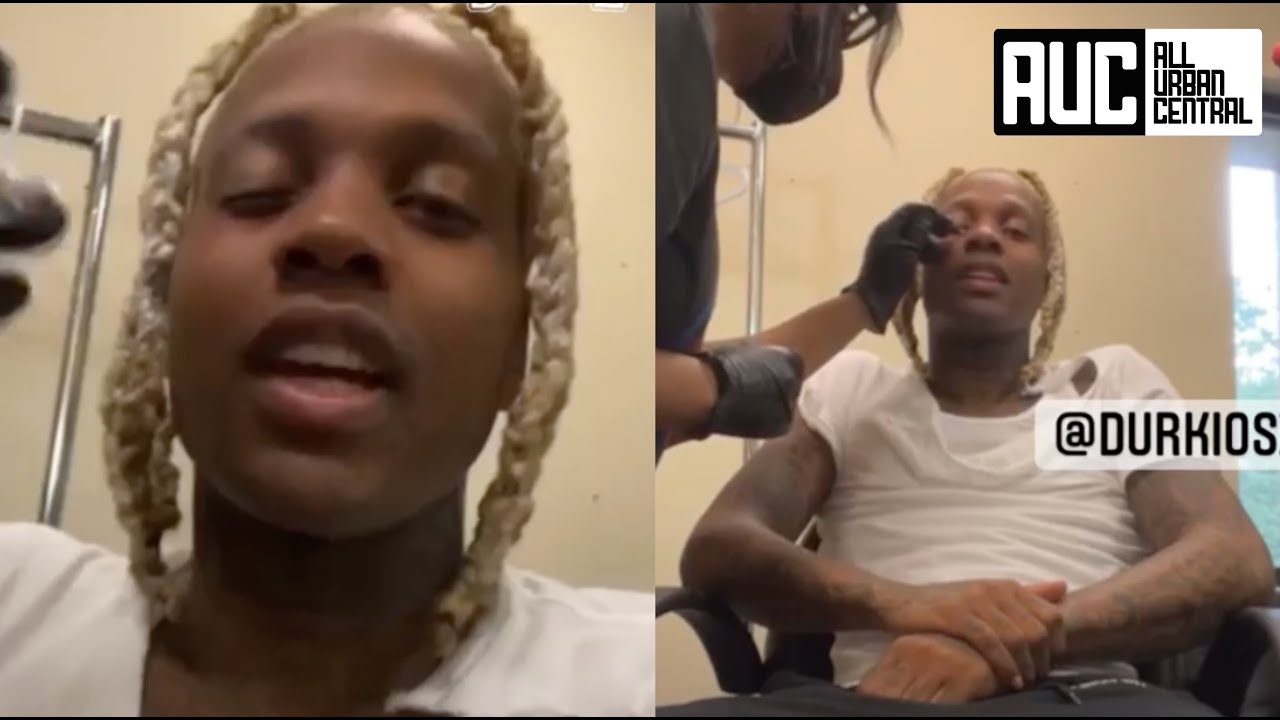 Lil Durk Gets A Black Eye On Set Vows To Never Have One Again
