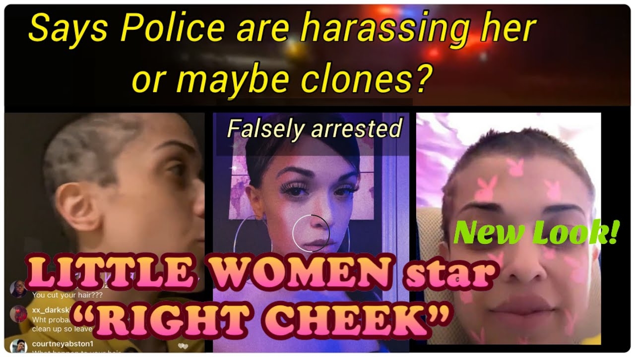 RightCheek bald, paranoid, says Dallas PR harassing her & illegally arrested her