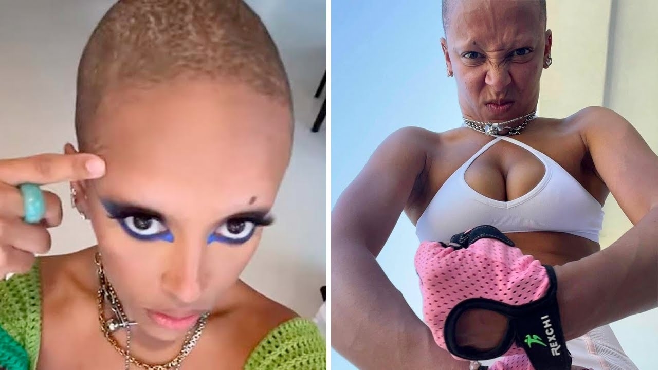 Doja Cat Responds to Mental Health Concerns After Shaving Her Head! #shorts