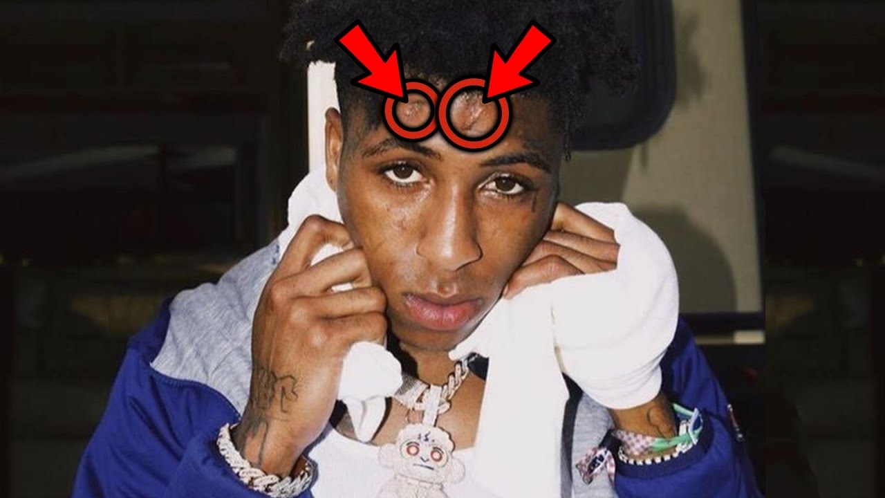 Rappers Who Almost Died