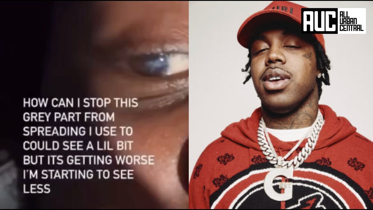 EST Gee Reacts To Going Blind In His Eye "How Can I Stop This"