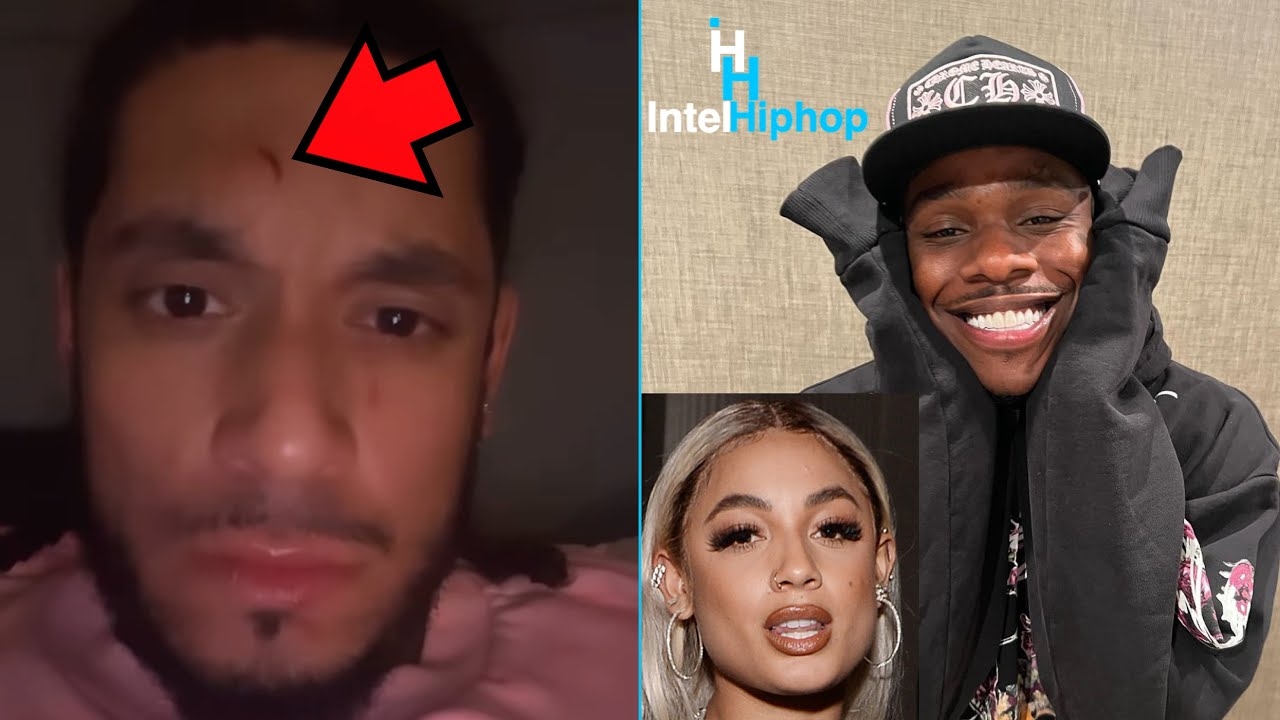 DaniLeigh Brother shows how flawless his face is after getting beat down by Dababy at Bowling alley