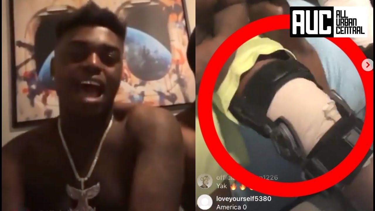"Bout Time Yall Got Me" Kodak Black Responds After Getting Shot Shows Off Leg