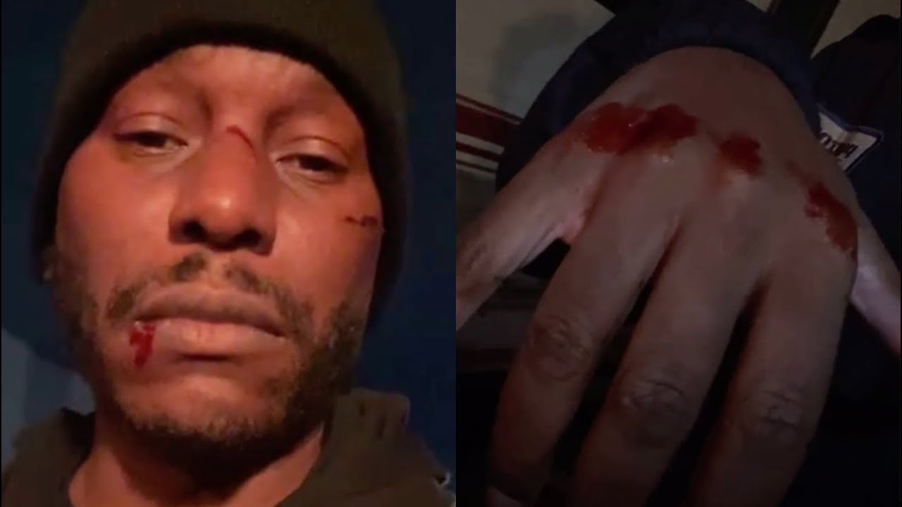 Tyrese Gets Beat Up On Movie Set Left Leaking