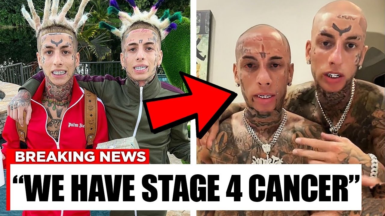 Why The Island Boys REALLY Went Bald..