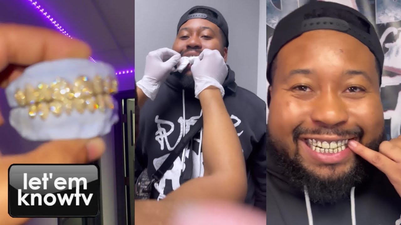 Dj Akademiks Cant Stop Smiling With His New Yellow Gold Grillz From Gleefull Grillz | Pure Jewelry