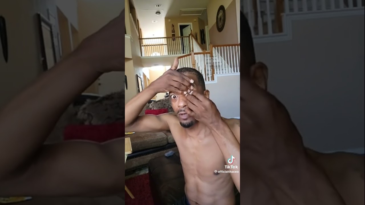 Charleston white pop out his glass eye