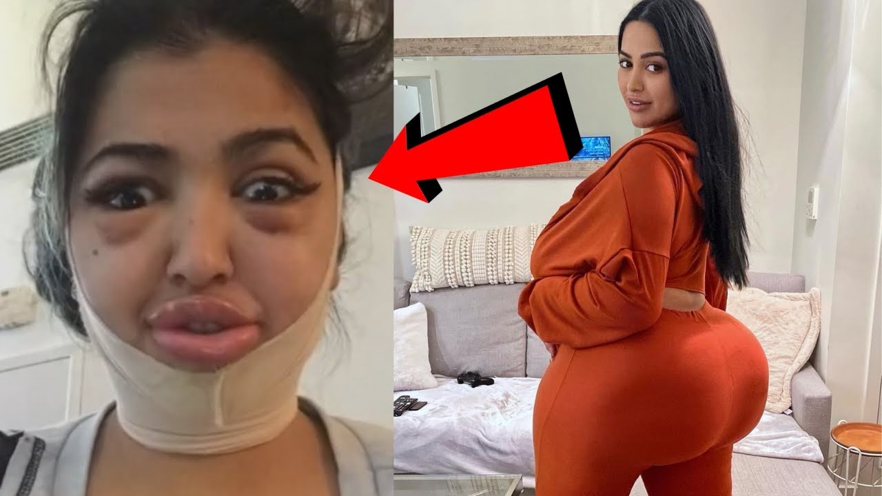 "WHEN PEOPLE GIVE ME ATTENTION I FEEL SPECIAL" 40 SURGERIES LATER...