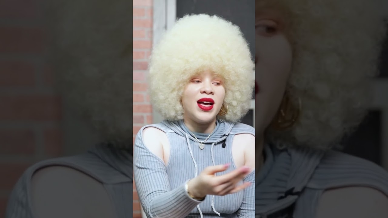 Pretty Porcelain Speaks On Misconceptions Of Albinism