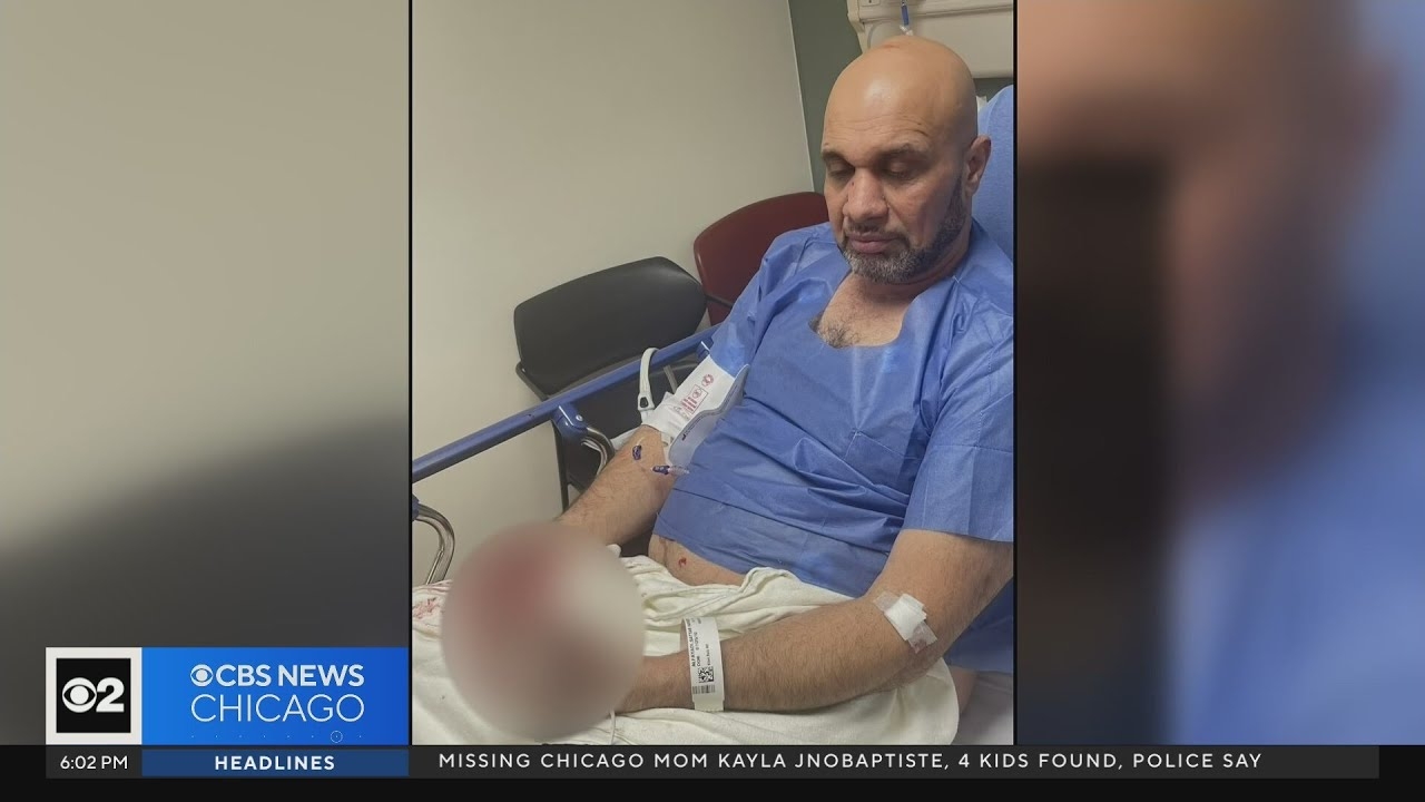 Elgin road rage victim speaks exclusively to CBS 2