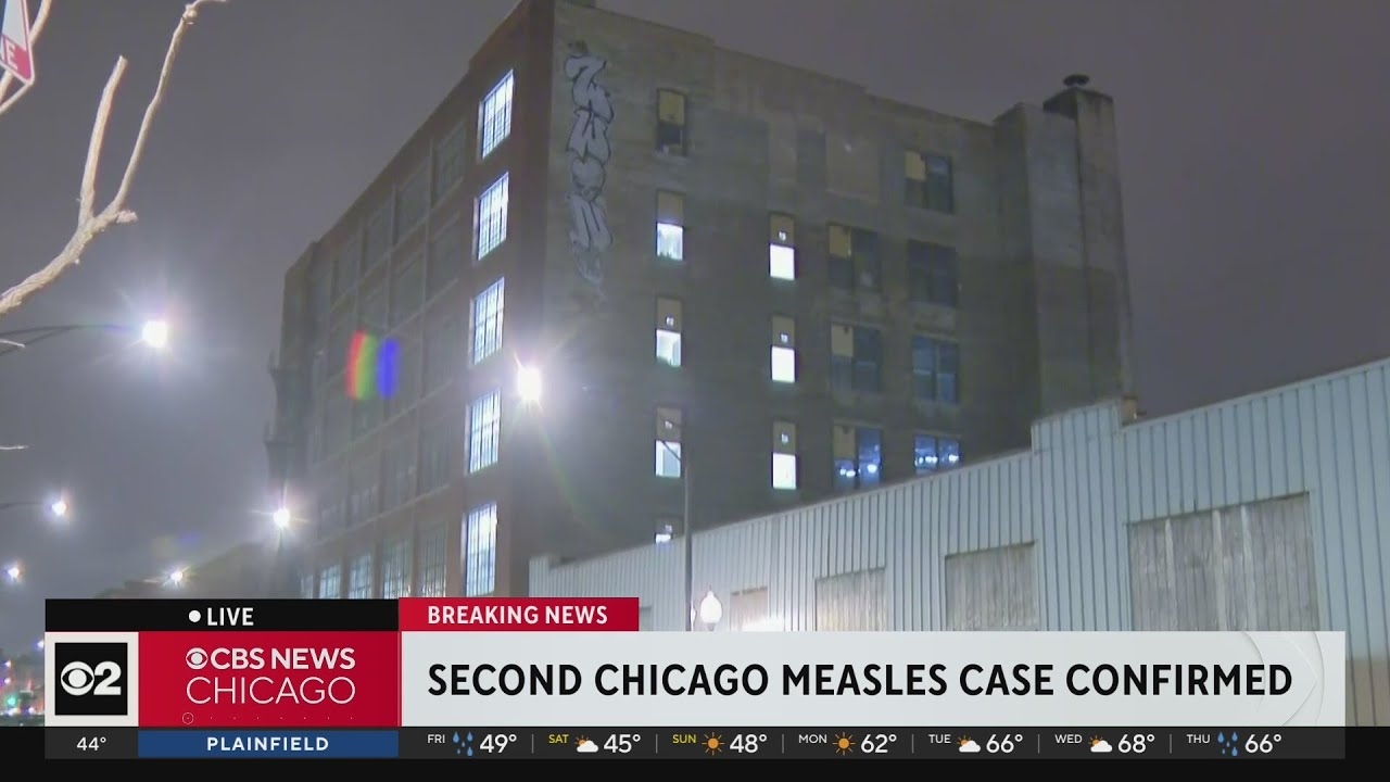 Chicago reports second measles case in 24 hours