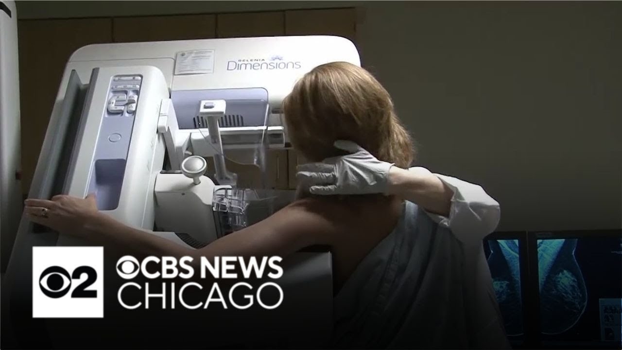 New breast cancer screening guidelines