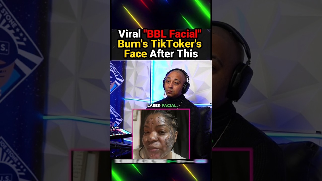 Her Viral BBL Facial Burn Experience #redditstories #shorts