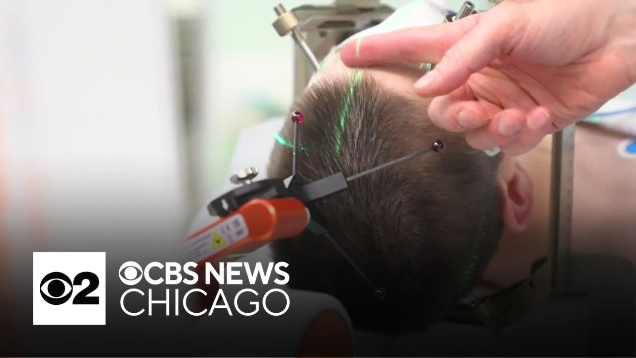 Boy becomes first person fitted with brain implant to control epileptic seizures