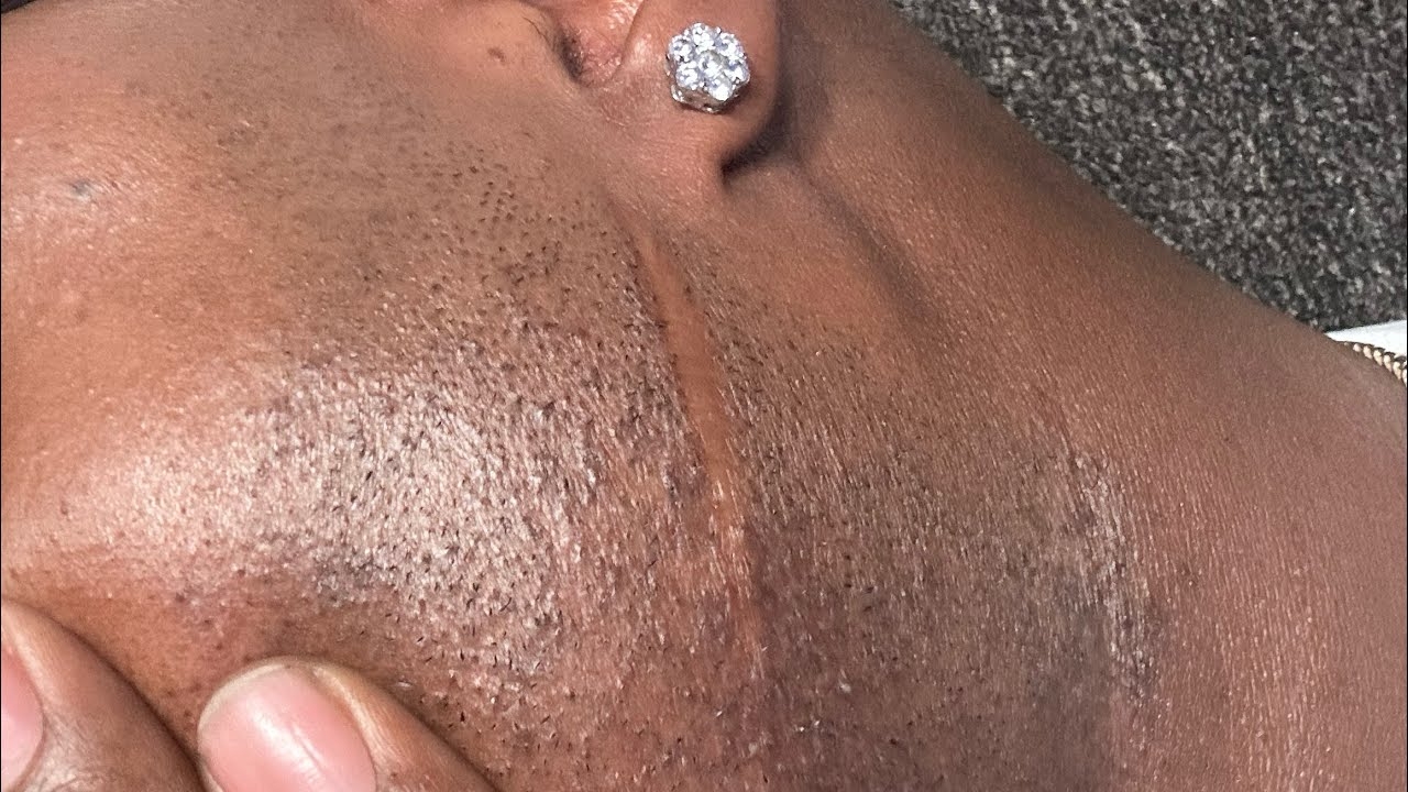 MATH HOFFA TELLS HOW HE GOT SCARRED, 1ST PIECE OF A** AND WHY HE CAN GO WITH A SMILE ON HIS FACE