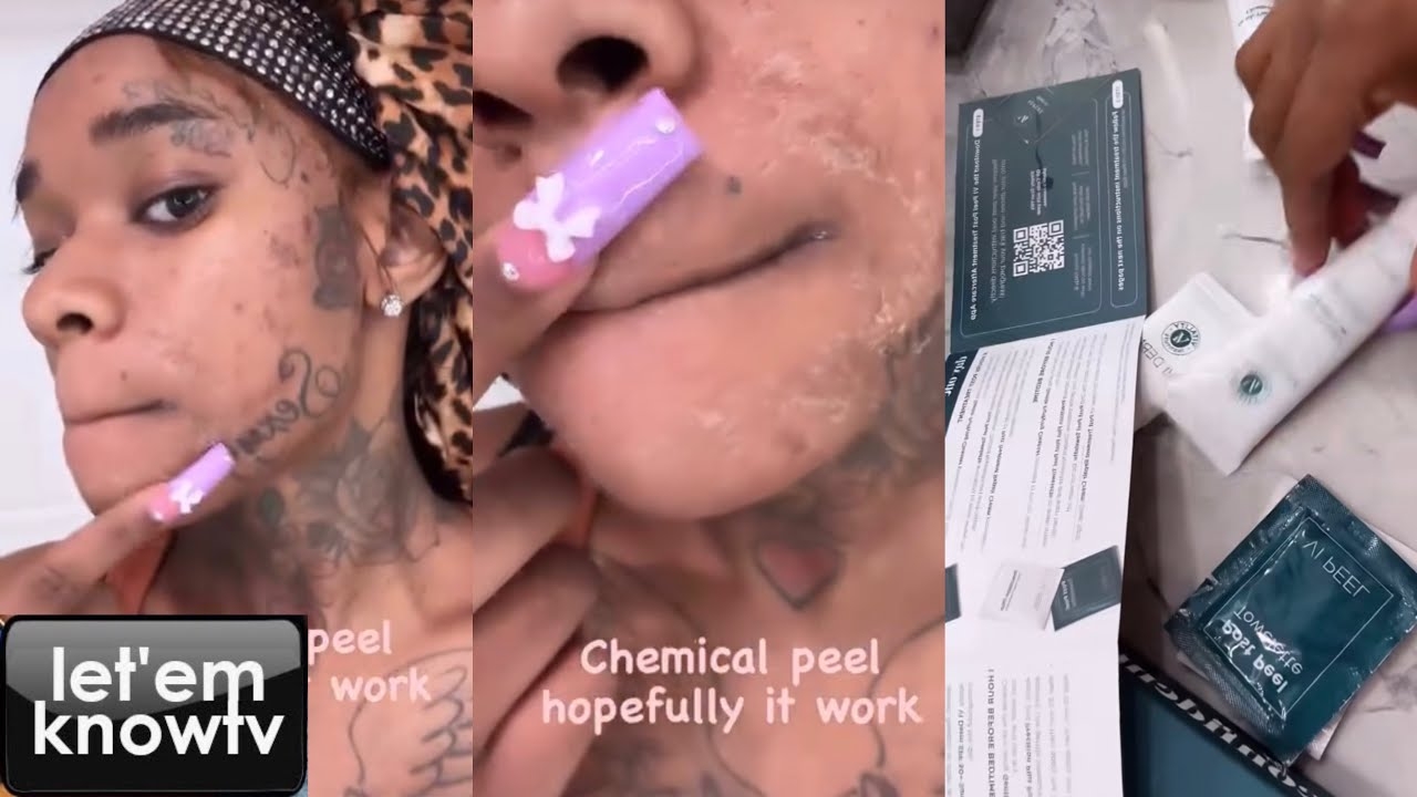 Sexyy Red Shows Her Skin Problems And What She Is Doing To Fix It