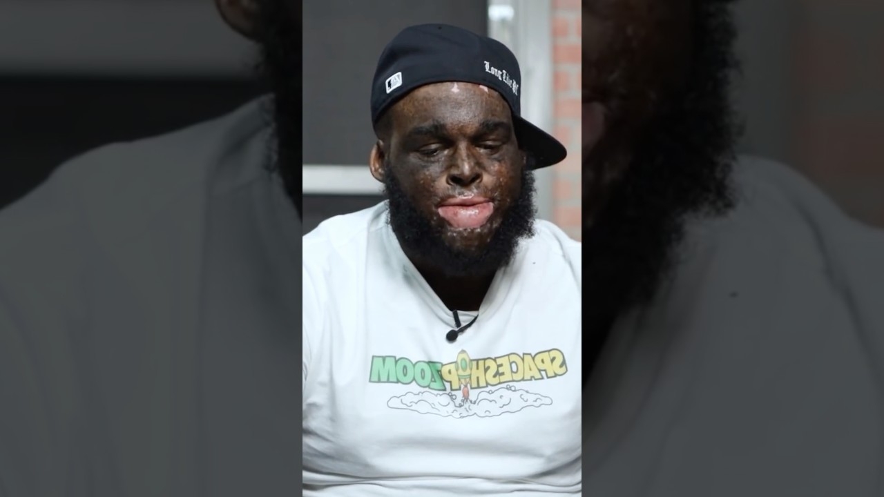 SKITSPRO details surviving a gas explosion inside a home
