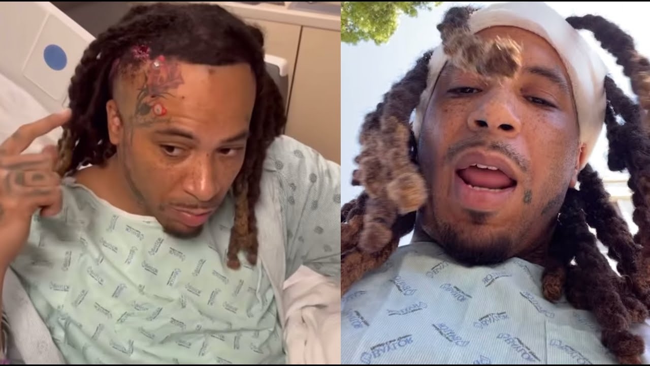 "My Brain Bleedin" Go Yayo Artist Bedo Responds After Being Shot In The Head Outside Club