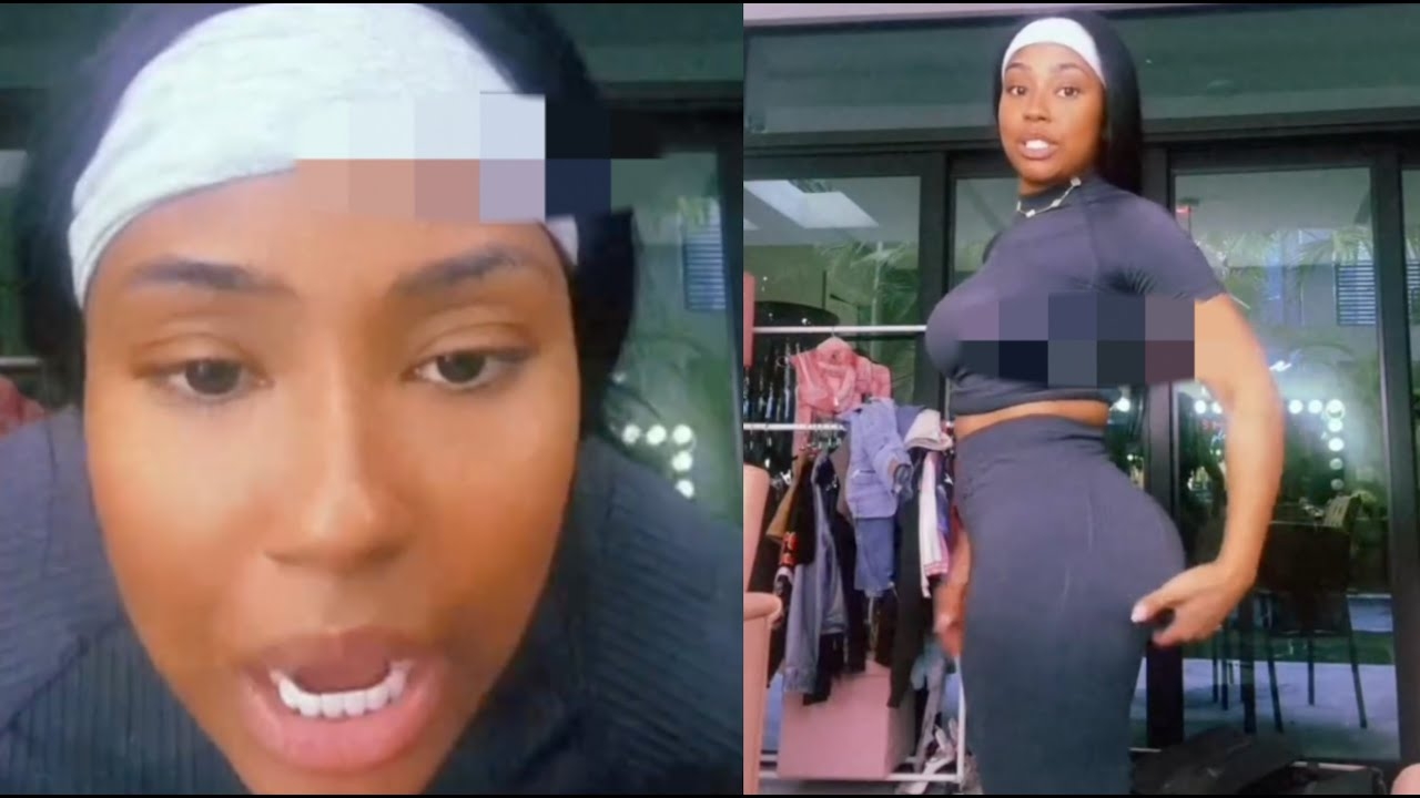 Who Yo Doctor Yung Miami Abruptly Ends Live After Fans Criticize Her BBL