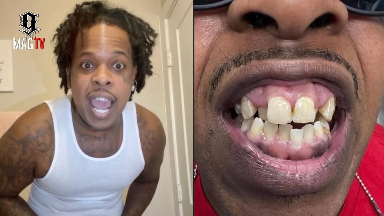 "Ya'll Ugly" Finesse2Tymes Wants Hands Wit Shawn Cotton After He Posted Picture Of His Old Teeth!