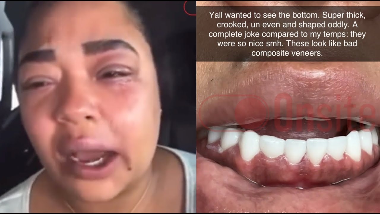 "Look At These Sh*ts" B Simone Sister Jordyn Has A Meltdown After Getting Janky Veneers In Atlanta