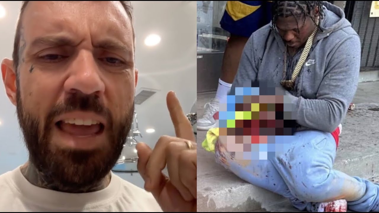 Theres More Bad News Adam22 REACTS To 4Xtra Blowing Off His Hand