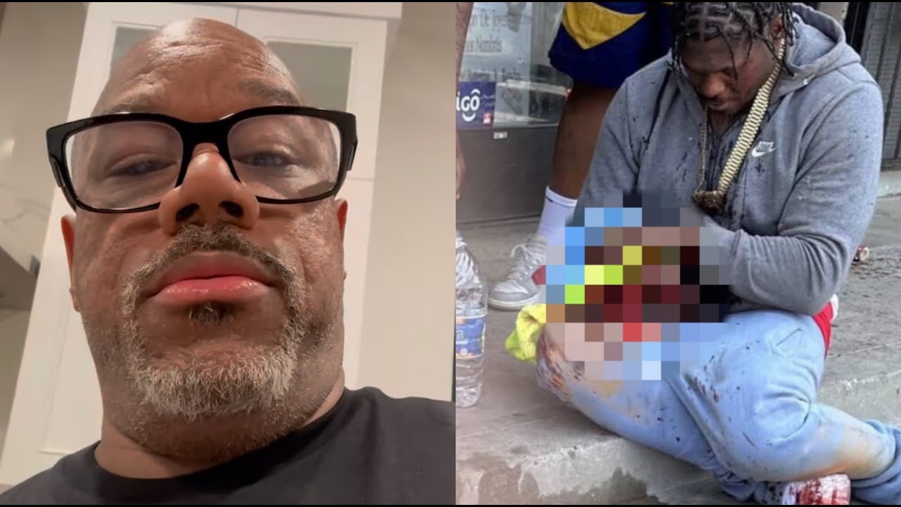 "There's Only 2 Fingers Left" Wack100 REACTS TO 4XTRA Blowing Off His Hand