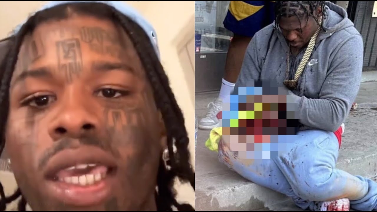 X4 Reacts To 4XTRA Blowing His Hand Off "Karma Struck Quick On Da Dead Homies"