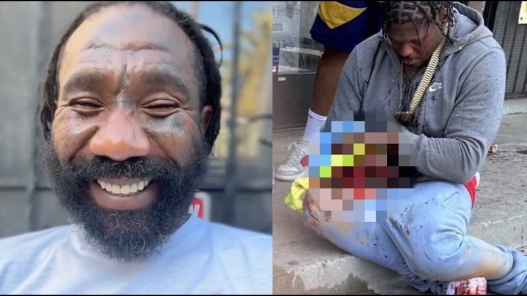 "Off Da Bone" Boskoe100 Reacts To 4XTRA Blowing Off His Hand