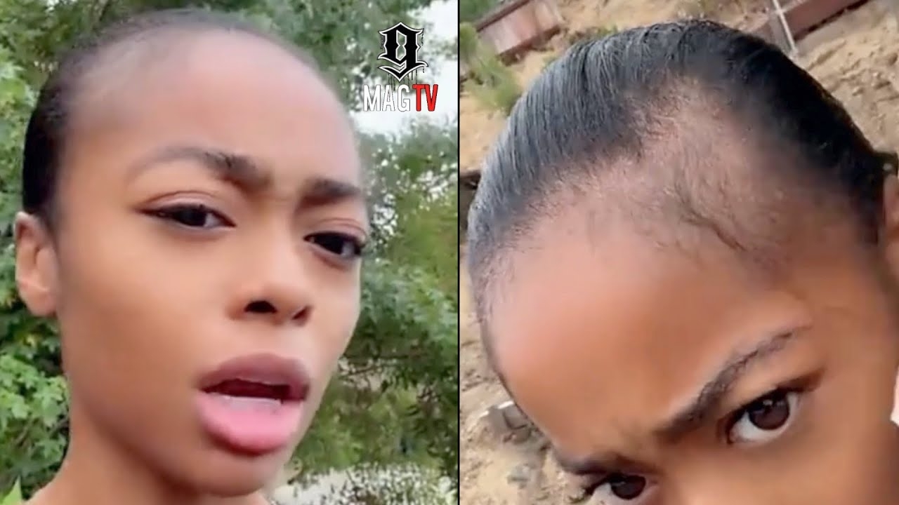 "I'm Getting Nervous" Skai Jackson Admits To Having Hair Loss After Giving Birth!