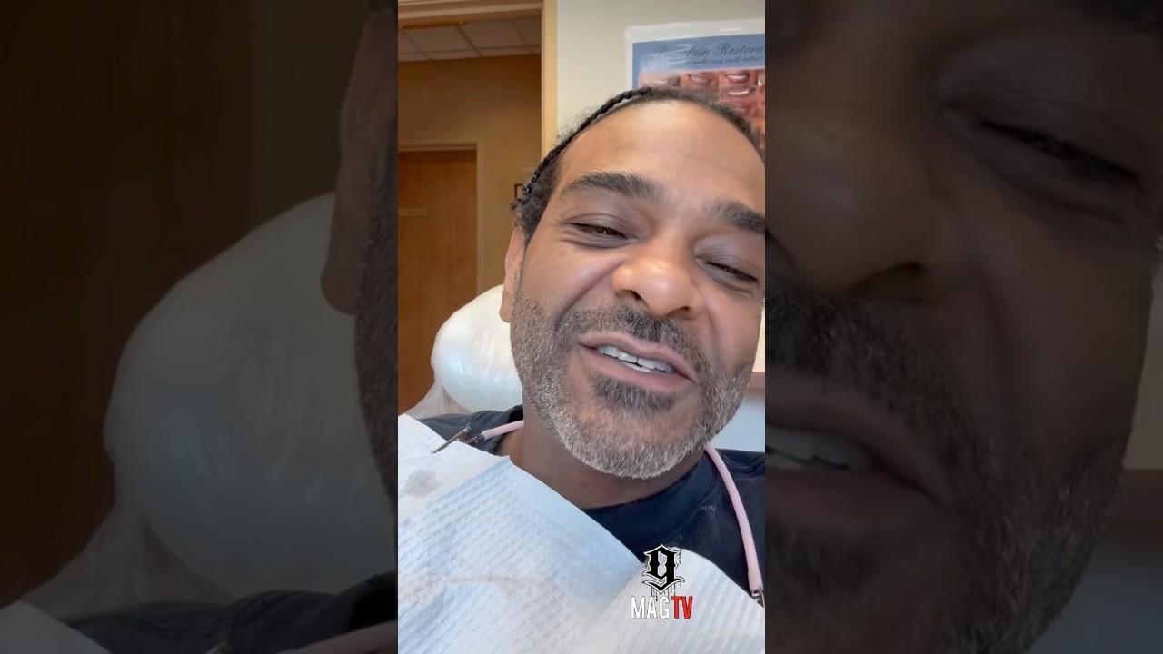 Jim Jones Says Its A No On Veneers