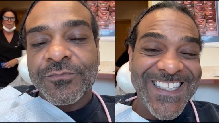 I Cant Afford Them Jim Jones Explains Why He Doesn't Have Veneers At Age 48