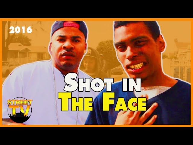 Surviving gun shot wound to the Face: East Coast Crip Opens Up About gang shooting