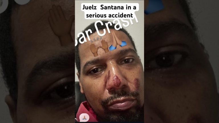 Julez Santana in a serious car accident