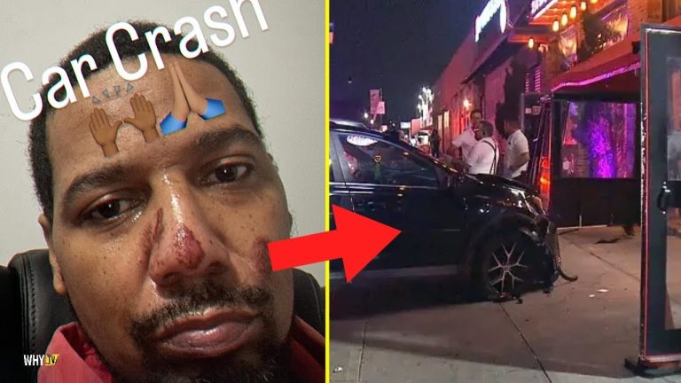 Juelz Santana Reveals Scars After Car Crash 'Pray For Juelz Santana'