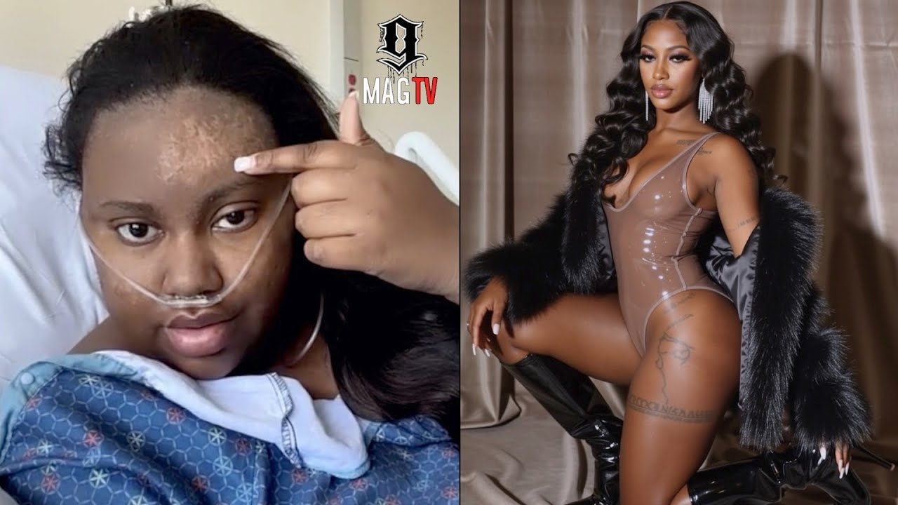 Gunplay's Ex Wife Vonshae Taylor Goes In For Surgery After Near Fatal Car Wreck!